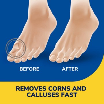 Dr. Scholl's Liquid Corn & Callus Remover, 0.33 oz