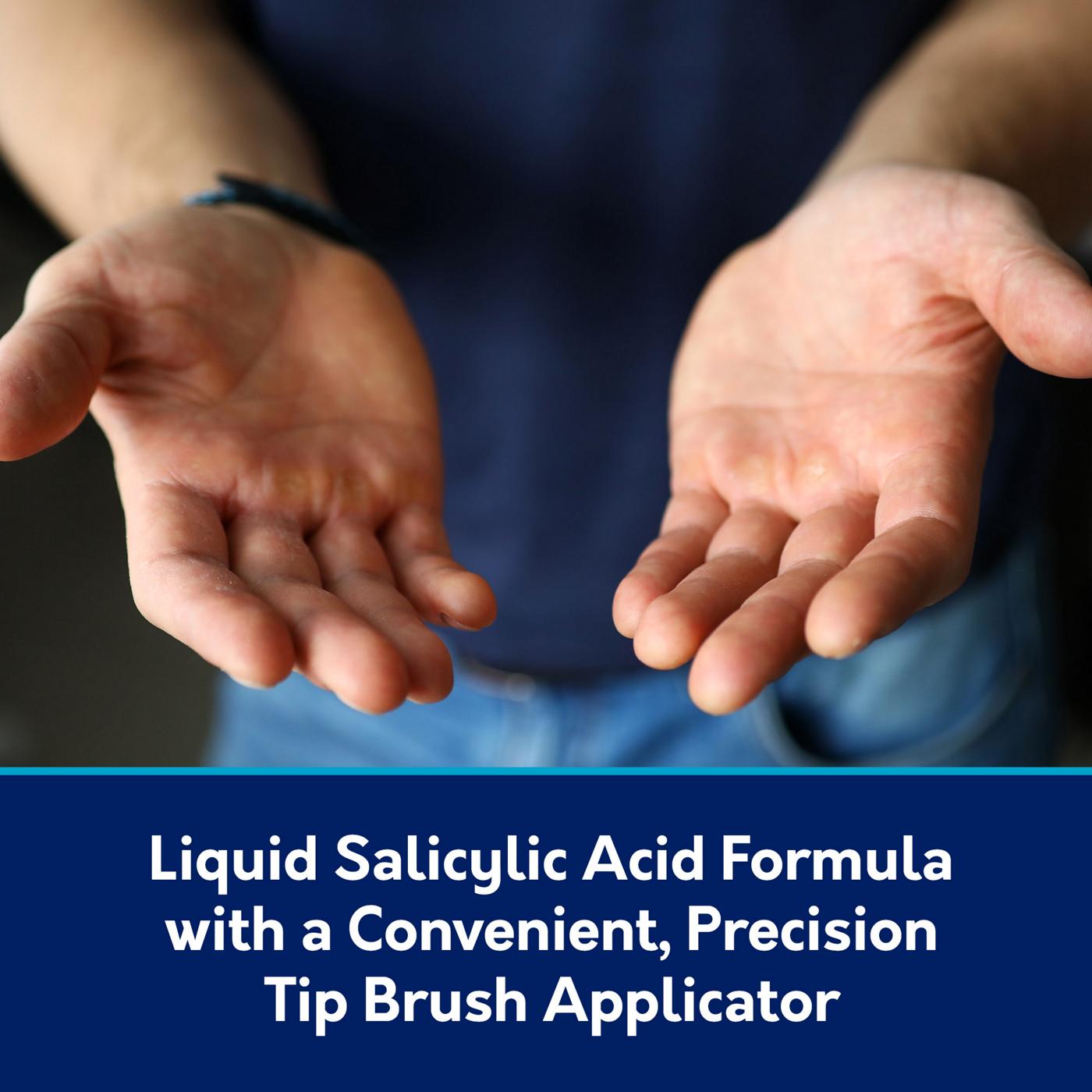 Compound W Maximum Strength Fast Acting Liquid Wart Remover; image 2 of 5