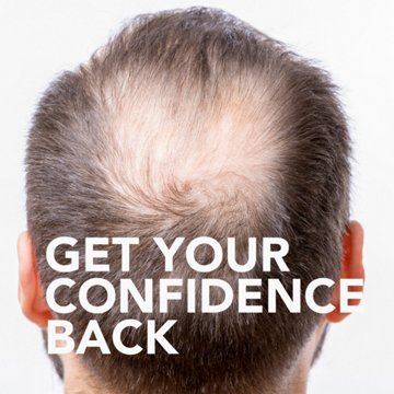 H-E-B 5% Minoxidil Hair Regrowth Treatment for Men - 3 Month Supply, 3 pk