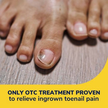 Dr. Scholl's Dr Scholls Ingrown Toenail Pain Reliever, 0.3 oz