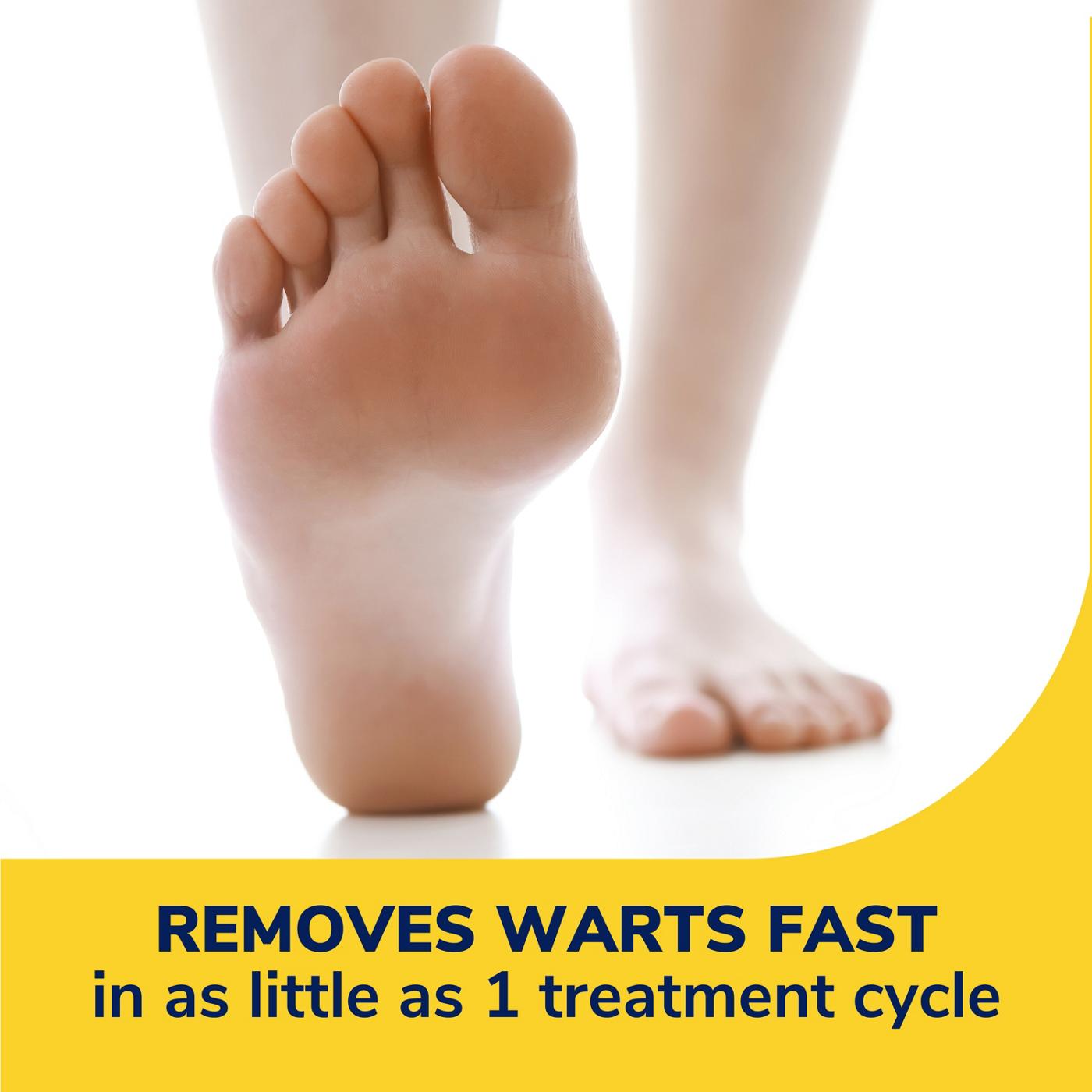 Compound W Wart Remover Strips - Shop Skin & Scalp Treatments at H-E-B