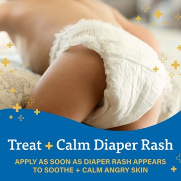 A+D Treat & Heal Diaper Rash Zinc Cream with Vitamins A+D