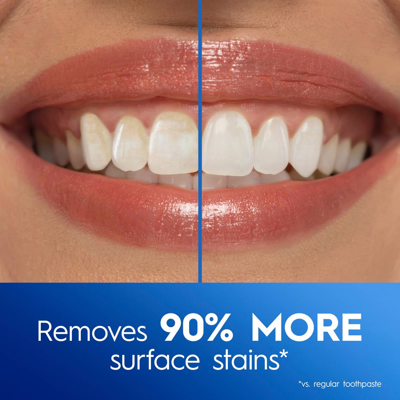 Crest 3DWhite Advanced Teeth Whitening Toothpaste - Radiant Mint; image 3 of 10