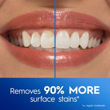 Crest 3DWhite Advanced Teeth Whitening Toothpaste - Radiant Mint, 6.6 oz