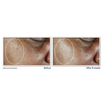 RoC 5-in-1 Daily Moisturizer