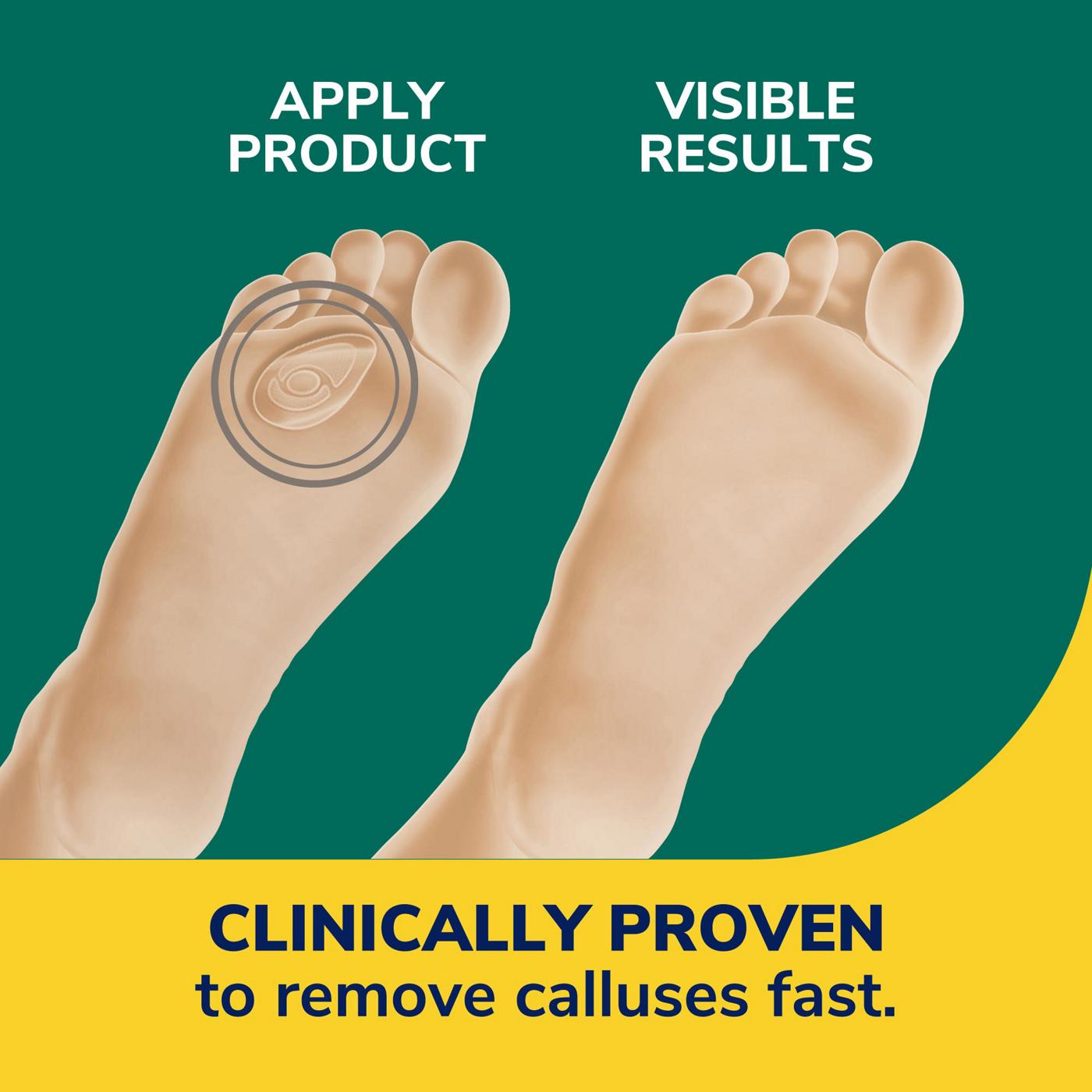 Dr. Scholl's Callus Removers; image 9 of 9