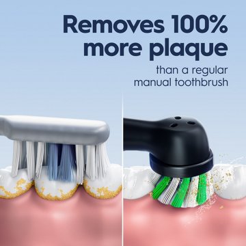 Oral-B Pro 1000 Rechargeable Toothbrush - Black