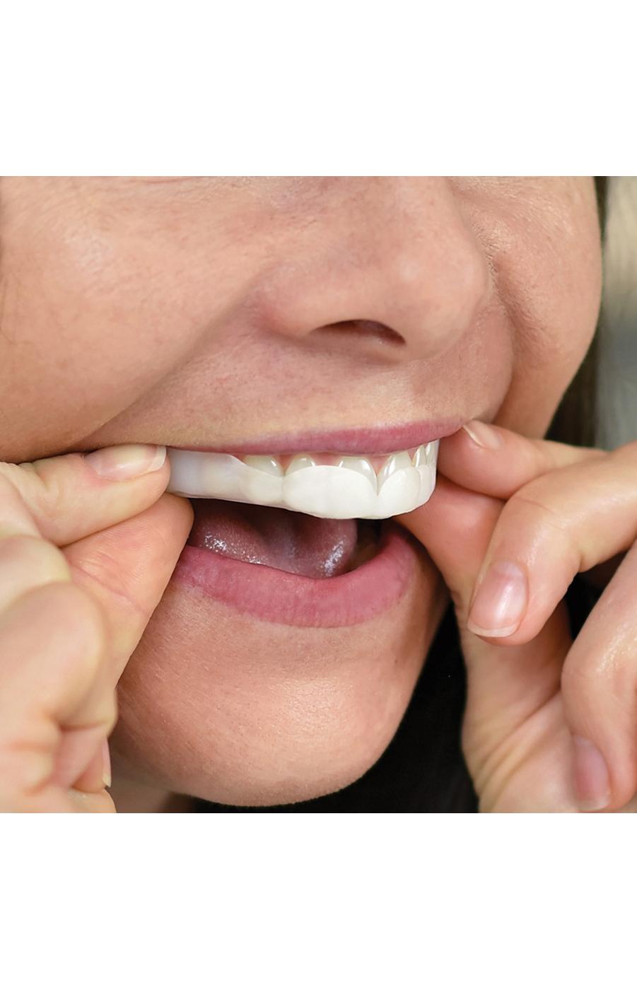 SleepRight ProRx Custom-Fit Dental Guard; image 4 of 8