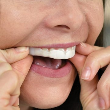 SleepRight ProRx Custom-Fit Dental Guard, 1 ct