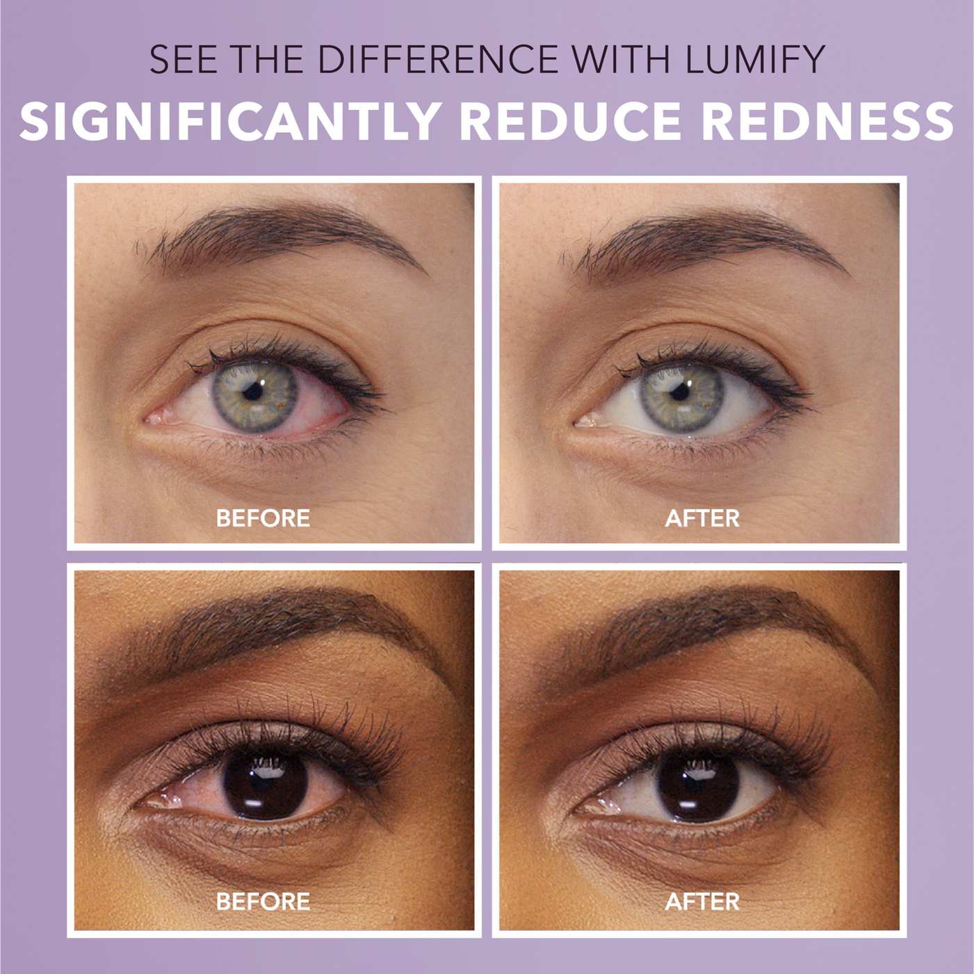 Bausch & Lomb Lumify Redness Reliever Eye Drops; image 4 of 6