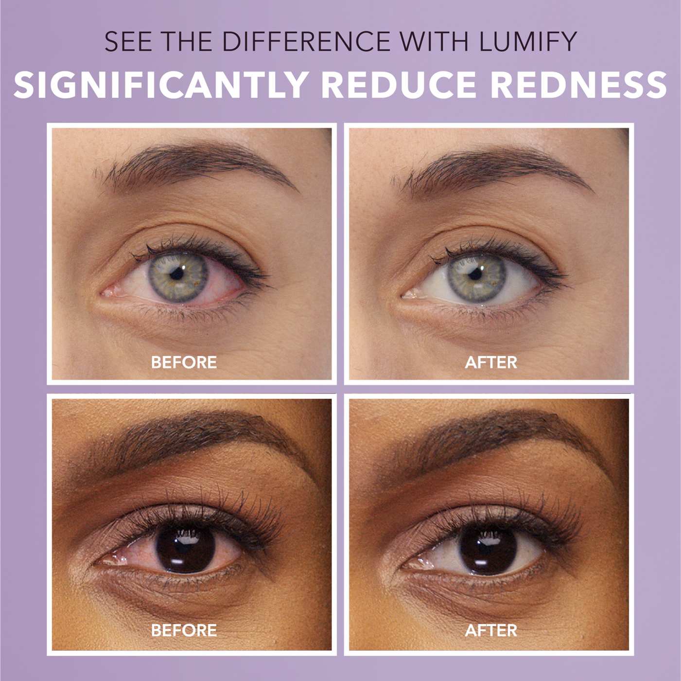 Bausch & Lomb Lumify Redness Reliever Eye Drops; image 3 of 6