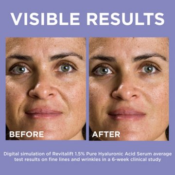 L'Oréal Paris Revitalift Derm Intensives Hyaluronic Acid Face Serum, 1 oz