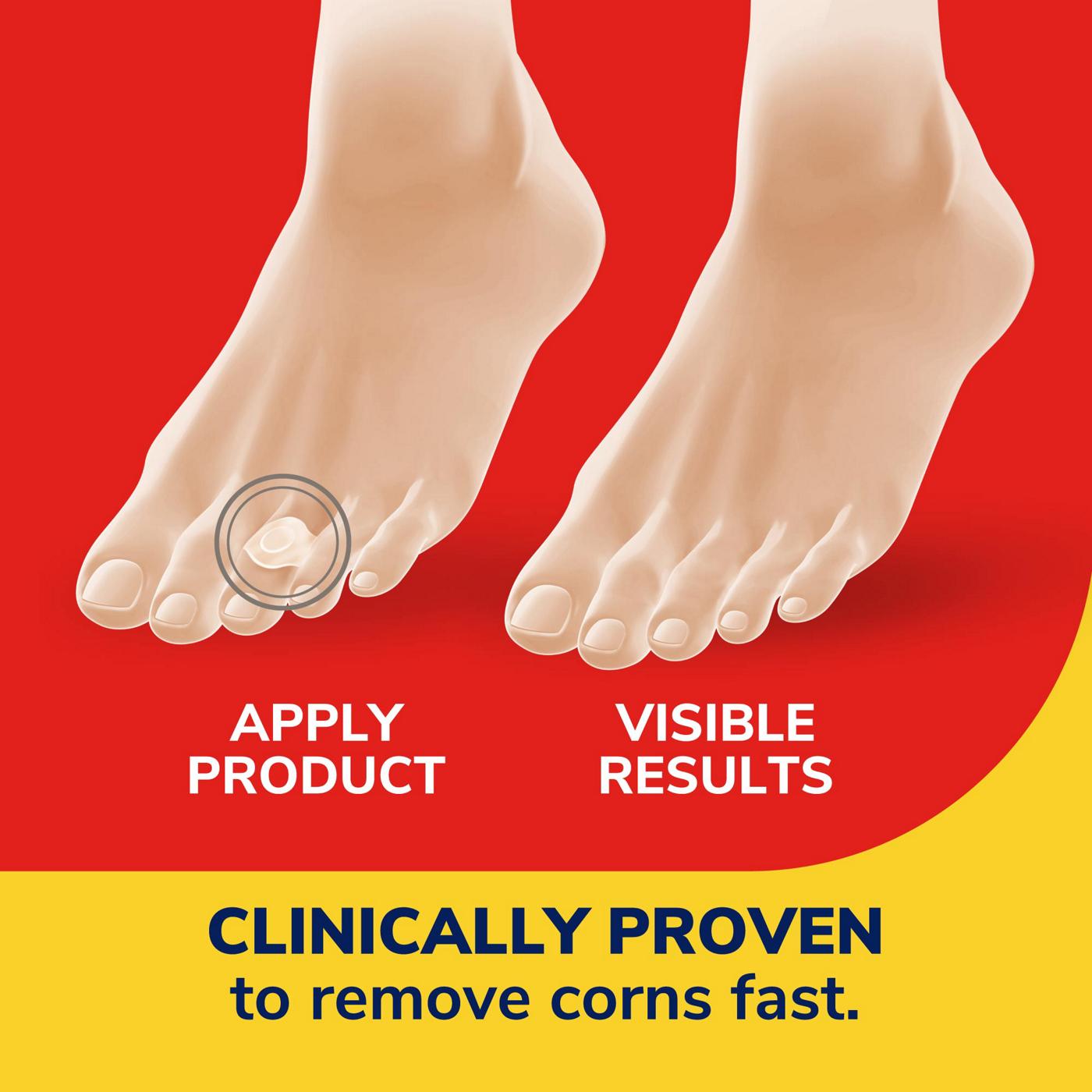 Dr. Scholl's Corn Removers; image 5 of 8