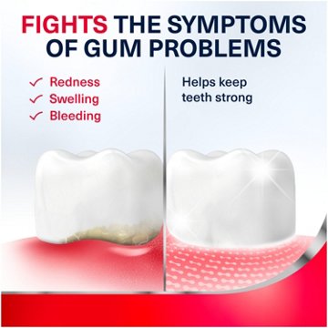 Parodontax Complete Protection Gingivitis Toothpaste for Bleeding Gums, Pure Fresh Mint