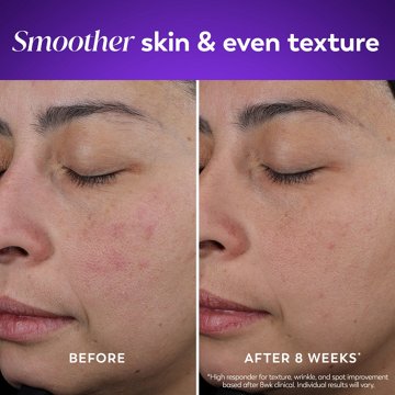 Olay Regenrist Retinol 24 Night Cream, 1.7 oz