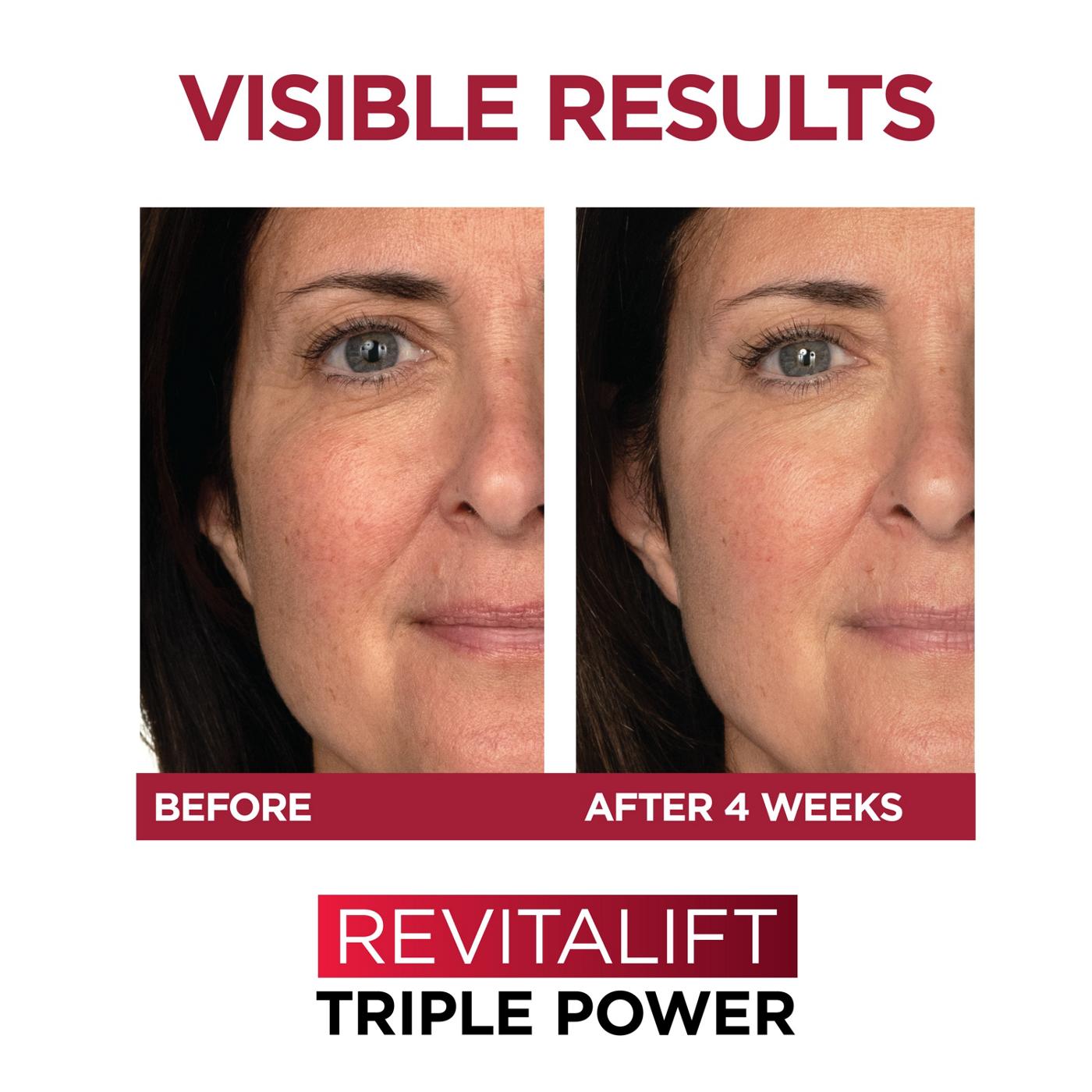 L'Oréal Paris Revitalift Triple Power Face Moisturizer, Fragrance Free; image 3 of 8