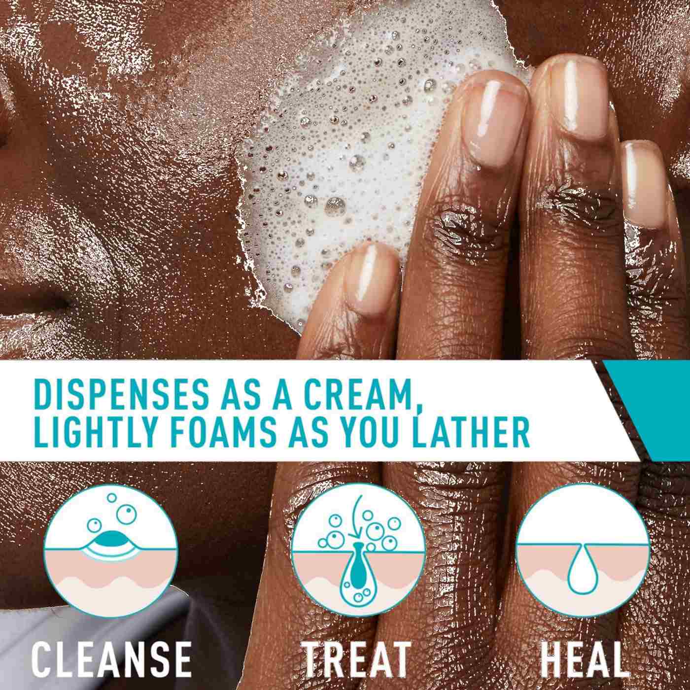 CeraVe Acne Foaming Cream Cleanser; image 3 of 8