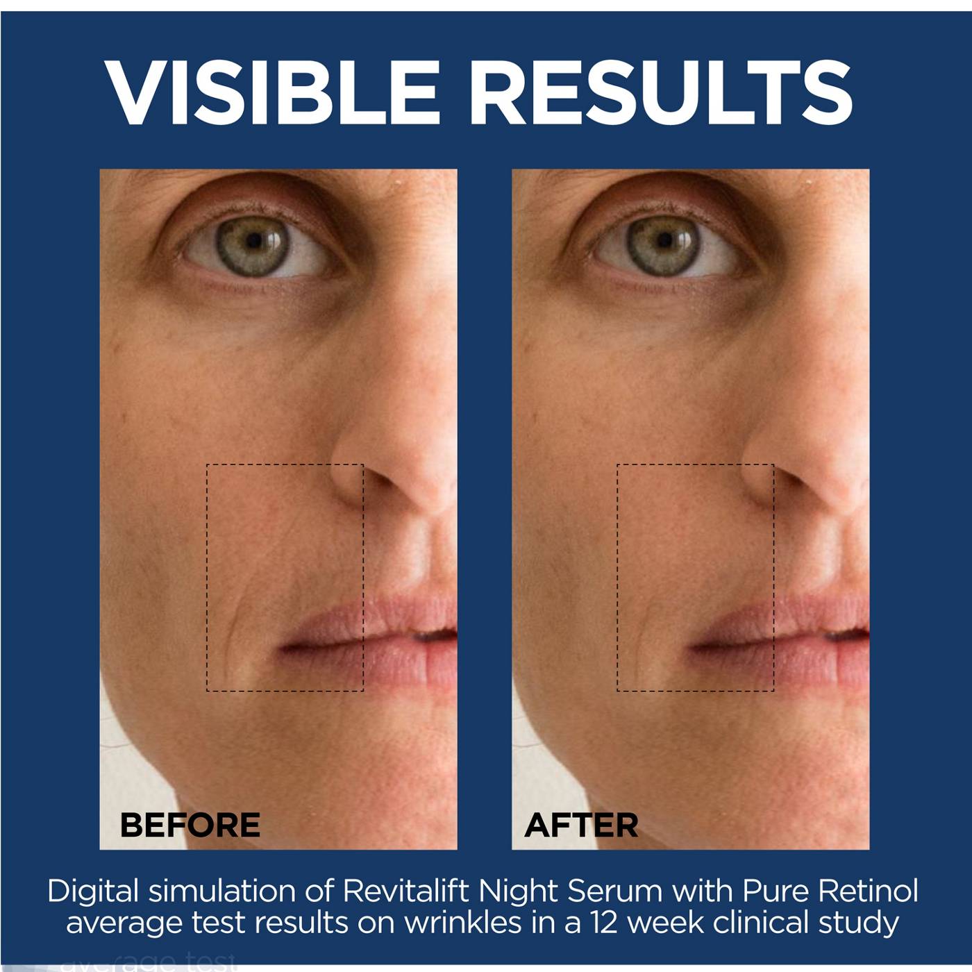 L'Oréal Paris Revitalift Derm Intensives Night Serum; image 3 of 8