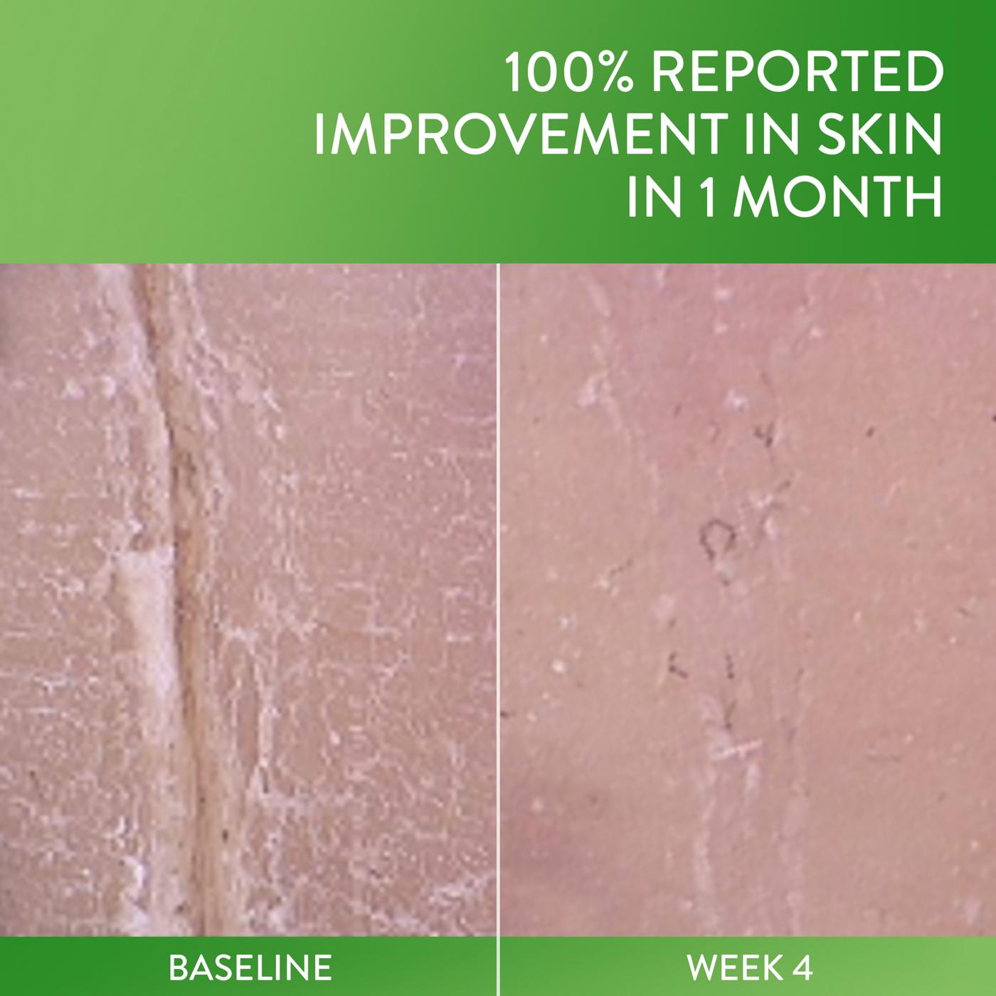 Cetaphil Cracked Skin Repair Lotion; image 3 of 8