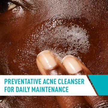 CeraVe Acne Control Cleanser