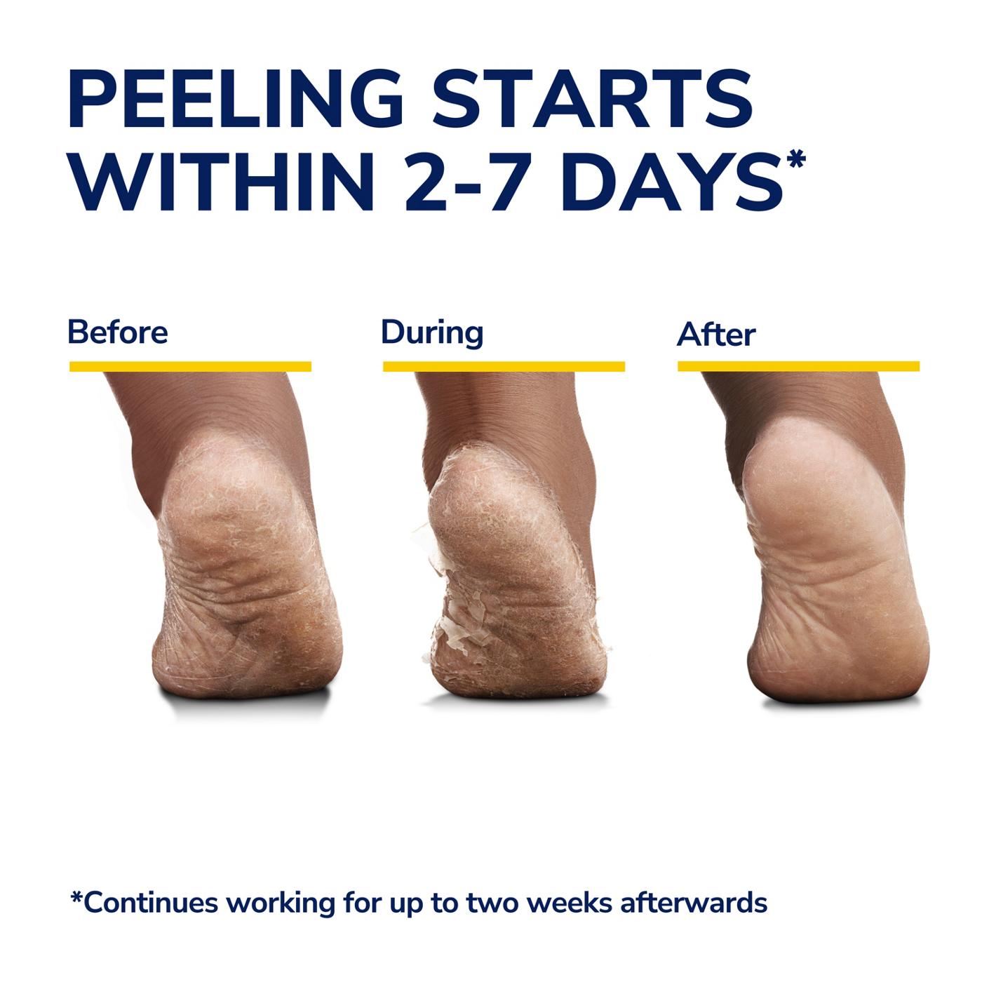 Dr. Scholl's Ultra-Exfoliating Foot Mask; image 4 of 8
