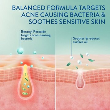 Cetaphil Gentle Clear Complexion-Clearing BPO Acne Cleanser