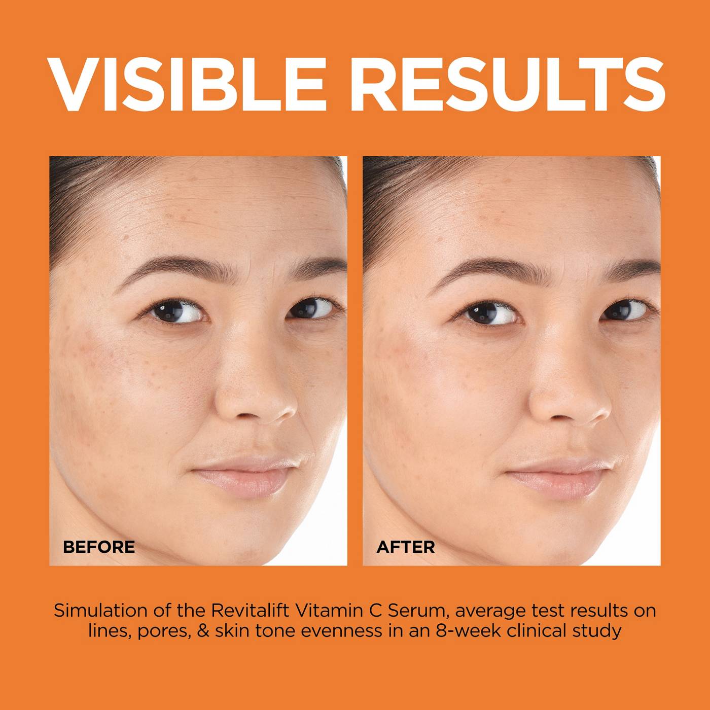 L'Oréal Paris Revitalift Derm Intensives 12% Vitamin C + E + Salicylic Acid Serum; image 9 of 9