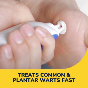 Dr. Scholl's Freese Away Max Wart Remover, 10 ct