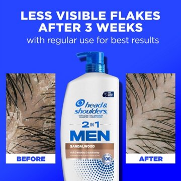 Head & Shoulders 2 in 1 Men Dandruff Shampoo + Conditioner - Sandalwood
