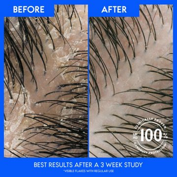 Head & Shoulders 2 in 1 Dandruff Shampoo + Conditioner - Classic Clean
