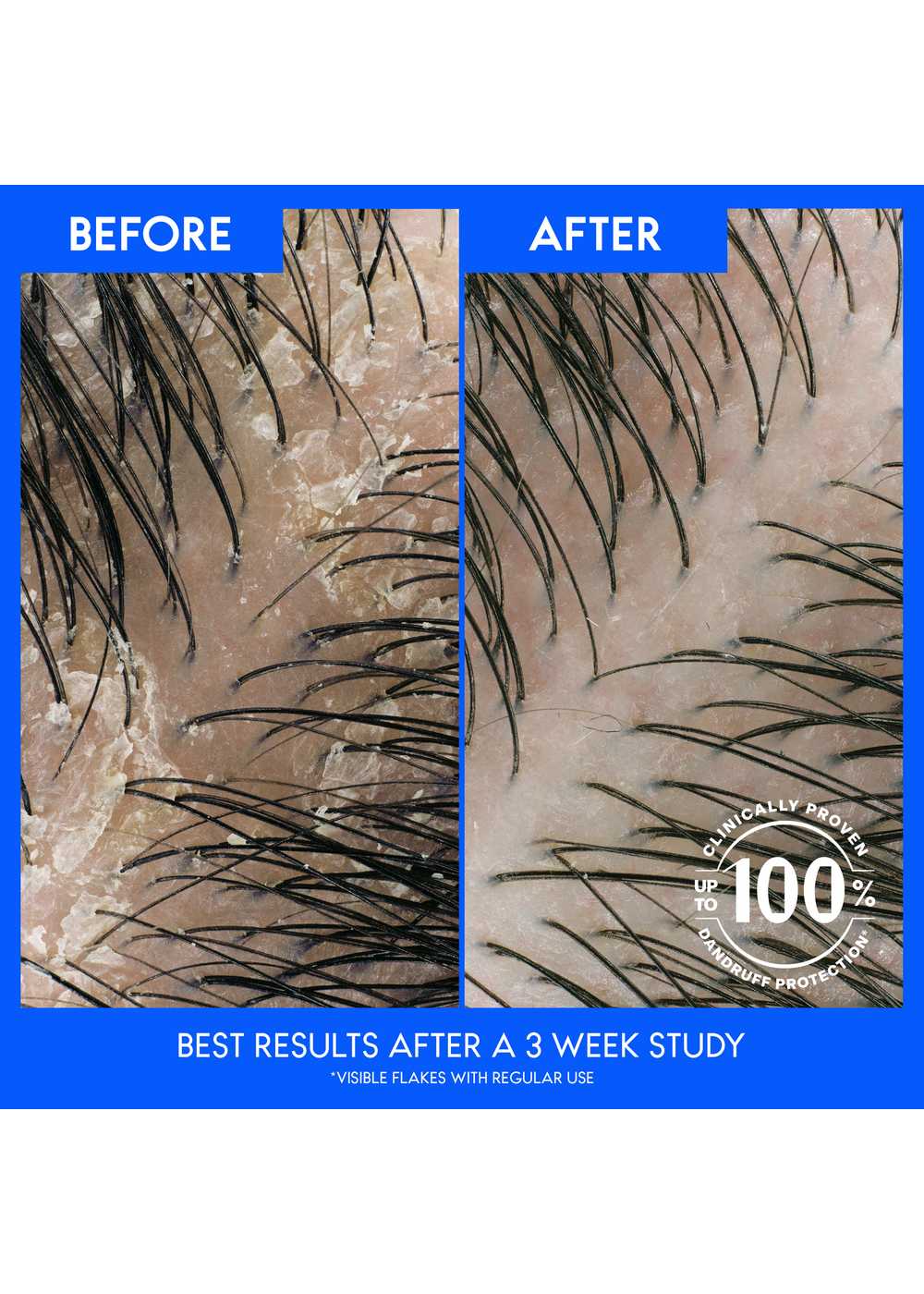 Head & Shoulders 2 in 1 Men Dandruff Shampoo + Conditioner - Sandalwood; image 5 of 11