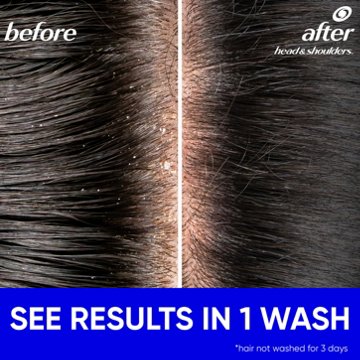 Head & Shoulders 2 in 1 Dandruff Shampoo + Conditioner - Tea Tree Oil