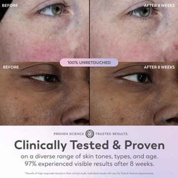 Olay Super Serum - Niacinamide, Vitamin C & E, Collagen Peptide, AHA - 5-in-1 Skin Care Benefits for Face, 1 oz