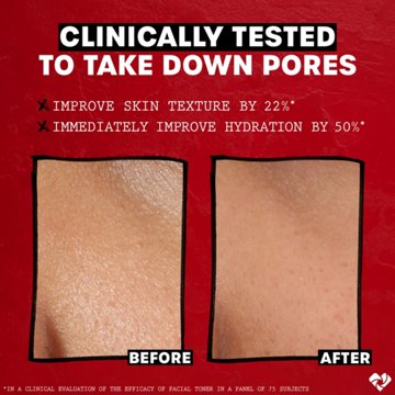 Thayers Witch Hazel Facial Toner - Cucumber, Alcohol Free, 8.5 oz