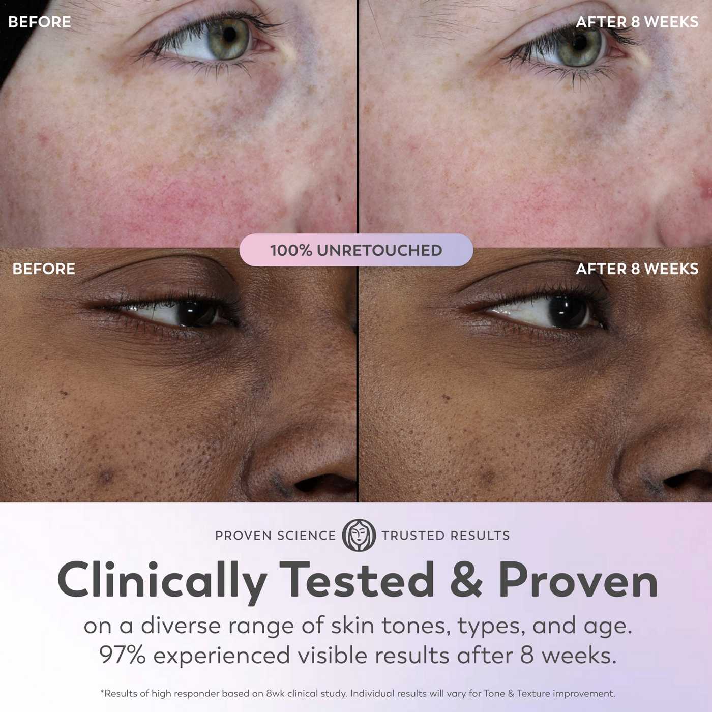 Olay Minis Super Serum; image 12 of 12