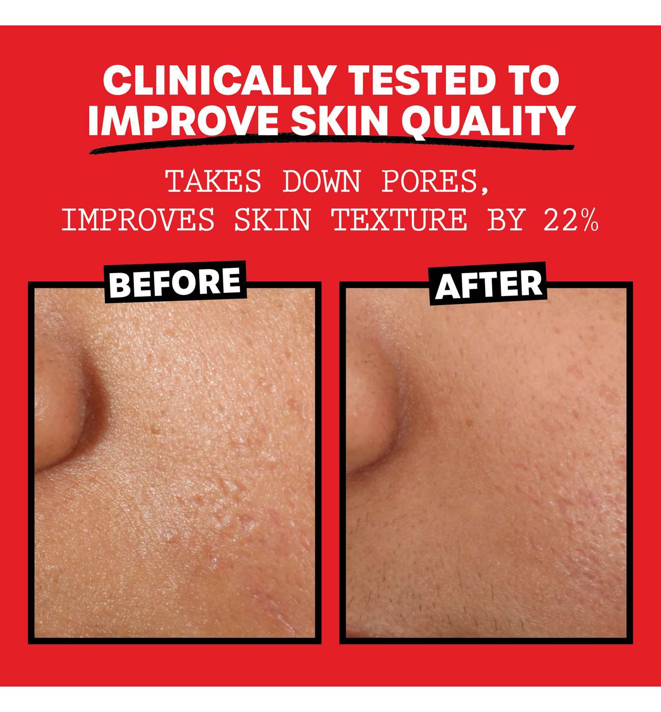 Thayers Witch Hazel Facial Toner - Unscented, Alcohol Free; image 3 of 6