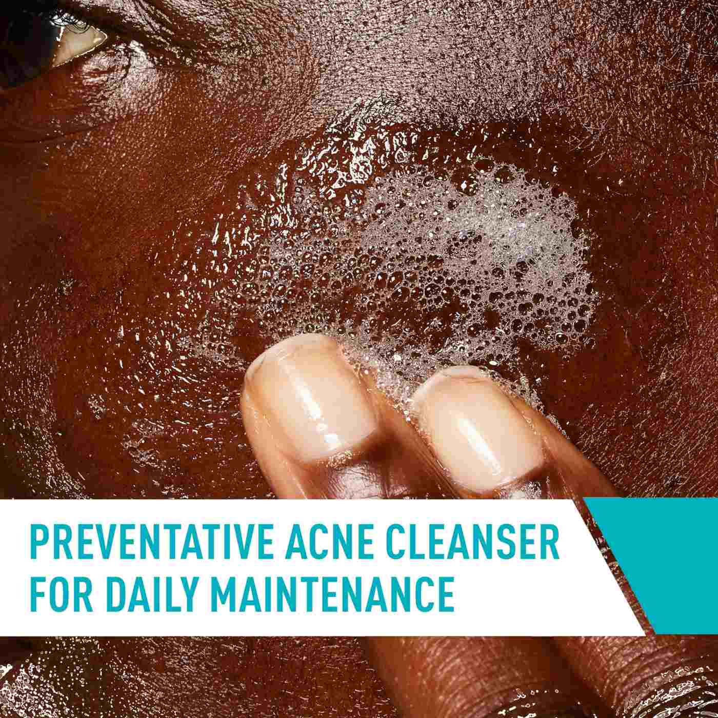 CeraVe Acne Control Cleanser; image 5 of 7
