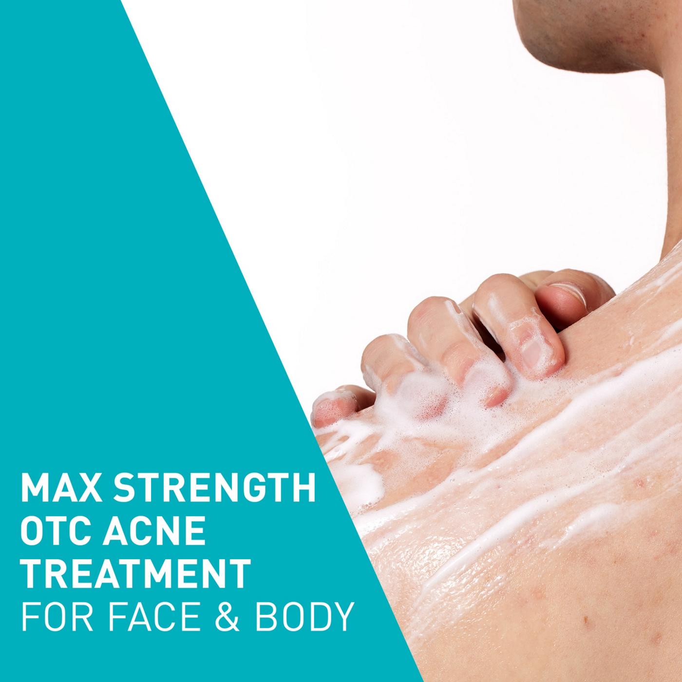 CeraVe Acne Foaming Cream Wash; image 7 of 10