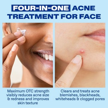 Differin Acne Benzoyl Peroxide Spot Treatment