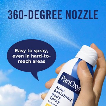 PanOxyl Acne Banishing Body Spray 2% Salicylic Acid