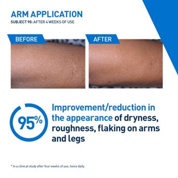 CeraVe Intensive Moisturizing Lotion, 12 oz