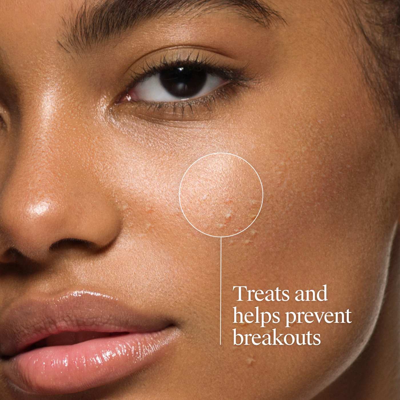 Neutrogena Oil-Free Acne Fighting Face Wash; image 5 of 8