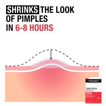 Neutrogena Hydrocolloid Sensitive Skin Acne Patches, 30 ct