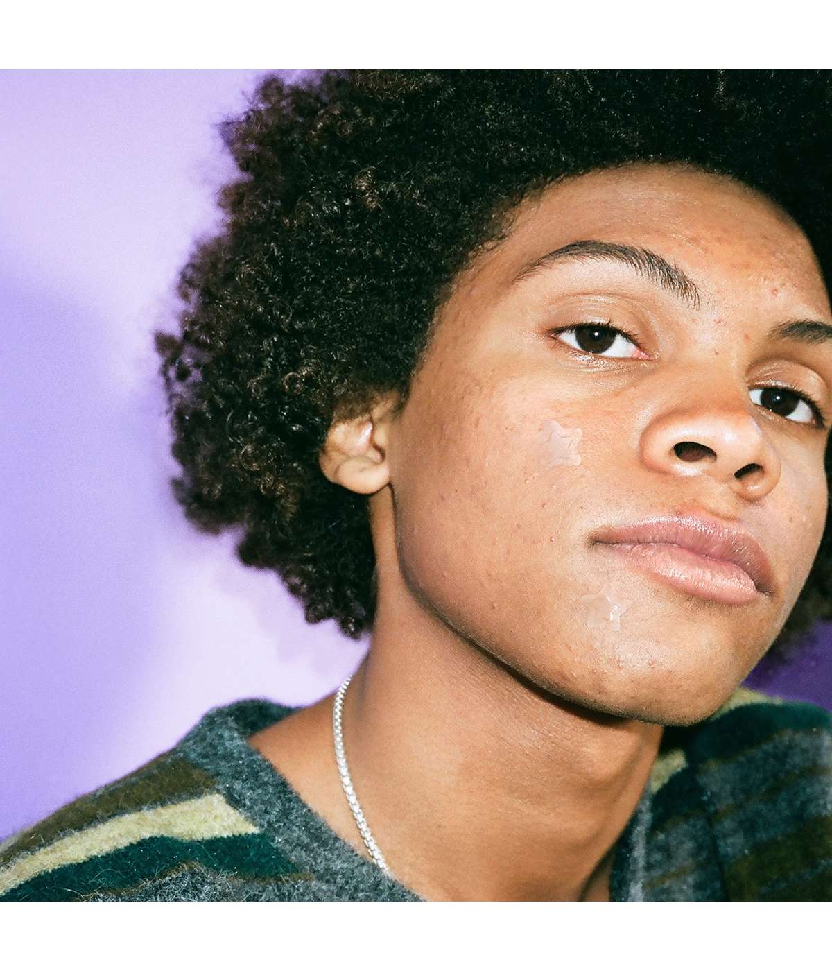 Starface Hydro-Star Clear Pimple Patches; image 5 of 6