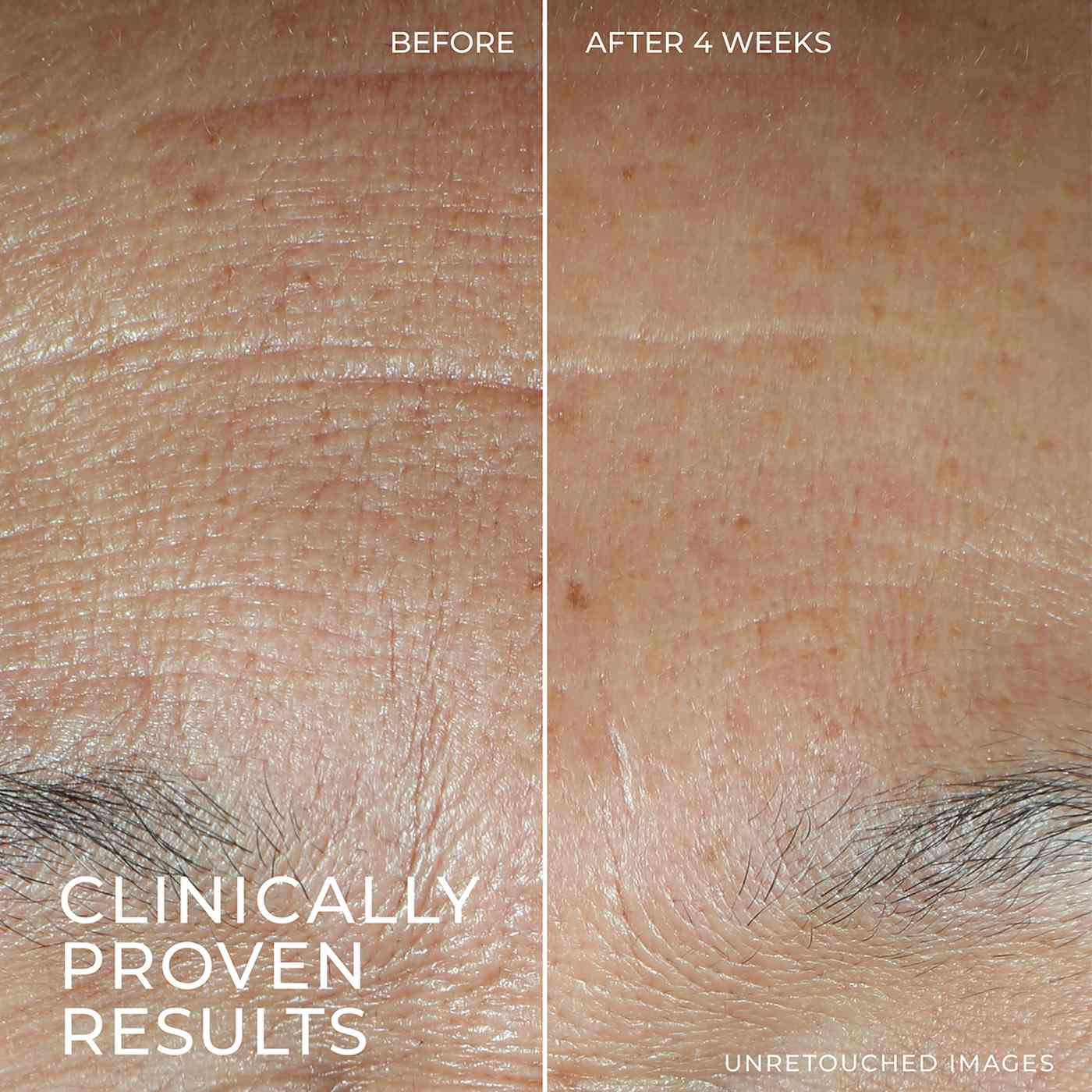 RoC Hyaluronic Acid Hydration+ Serum; image 8 of 8