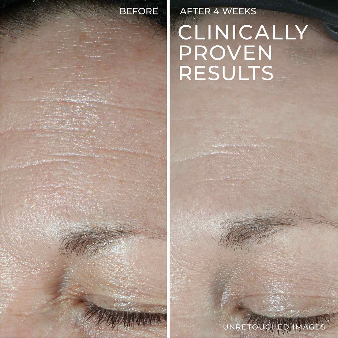 RoC Hyaluronic Acid Hydration+ Moisturizer; image 5 of 8