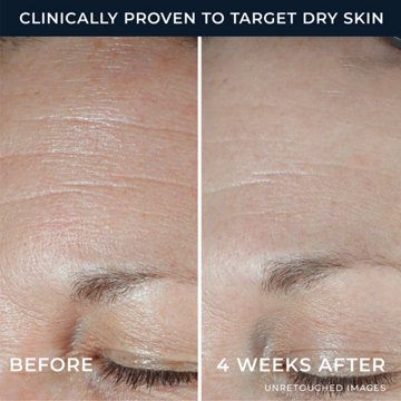 RoC Hyaluronic Acid Hydration+ Moisturizer