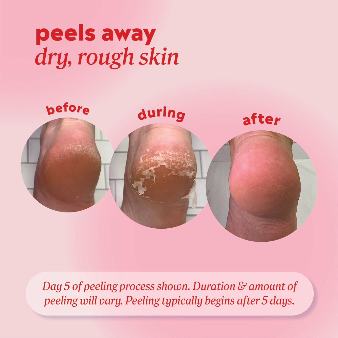 Onyx Professional Bye-EE Calluses Foot Mask; image 9 of 9