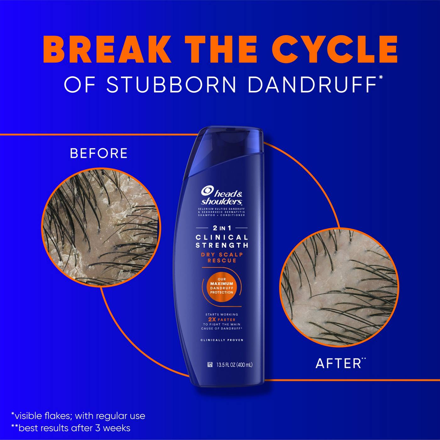 Head & Shoulders 2-in-1 Clinical Strength Dry Scalp Rescue Shampoo & Conditioner; image 5 of 9