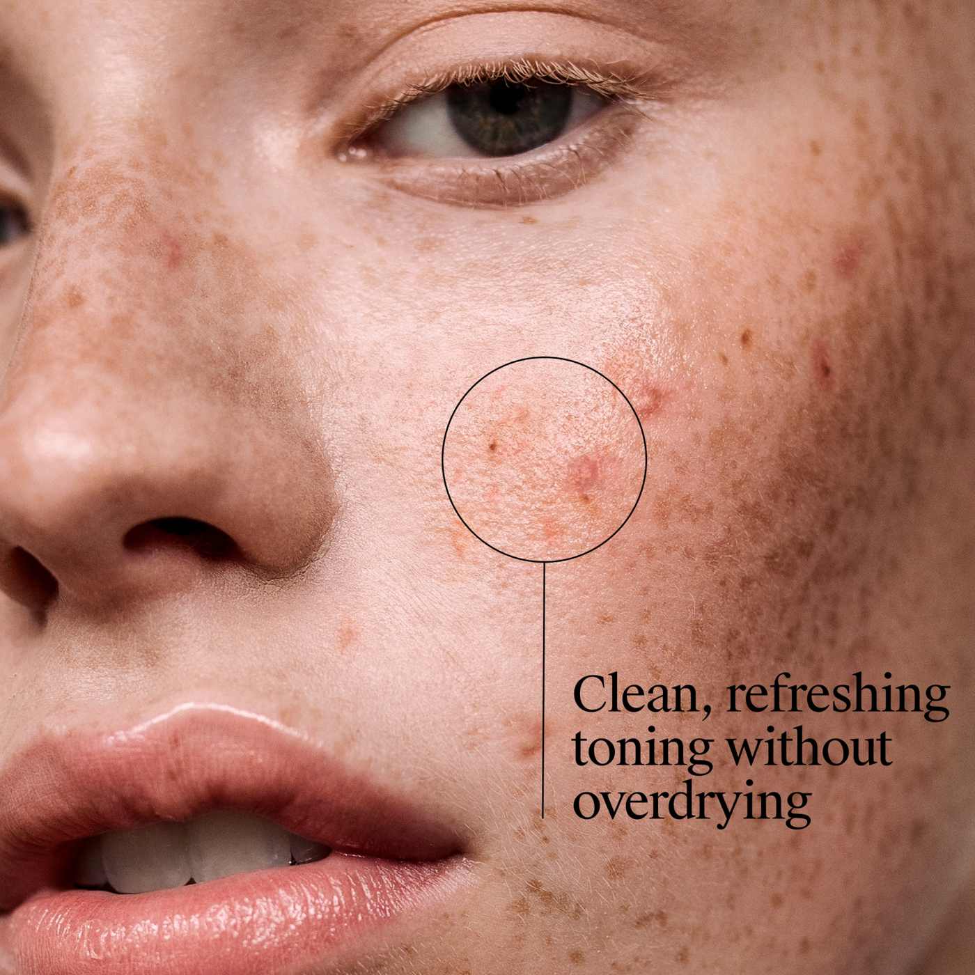 Neutrogena Acne Stress Control Triple-Action Toner with 2% salicylic acid; image 4 of 7